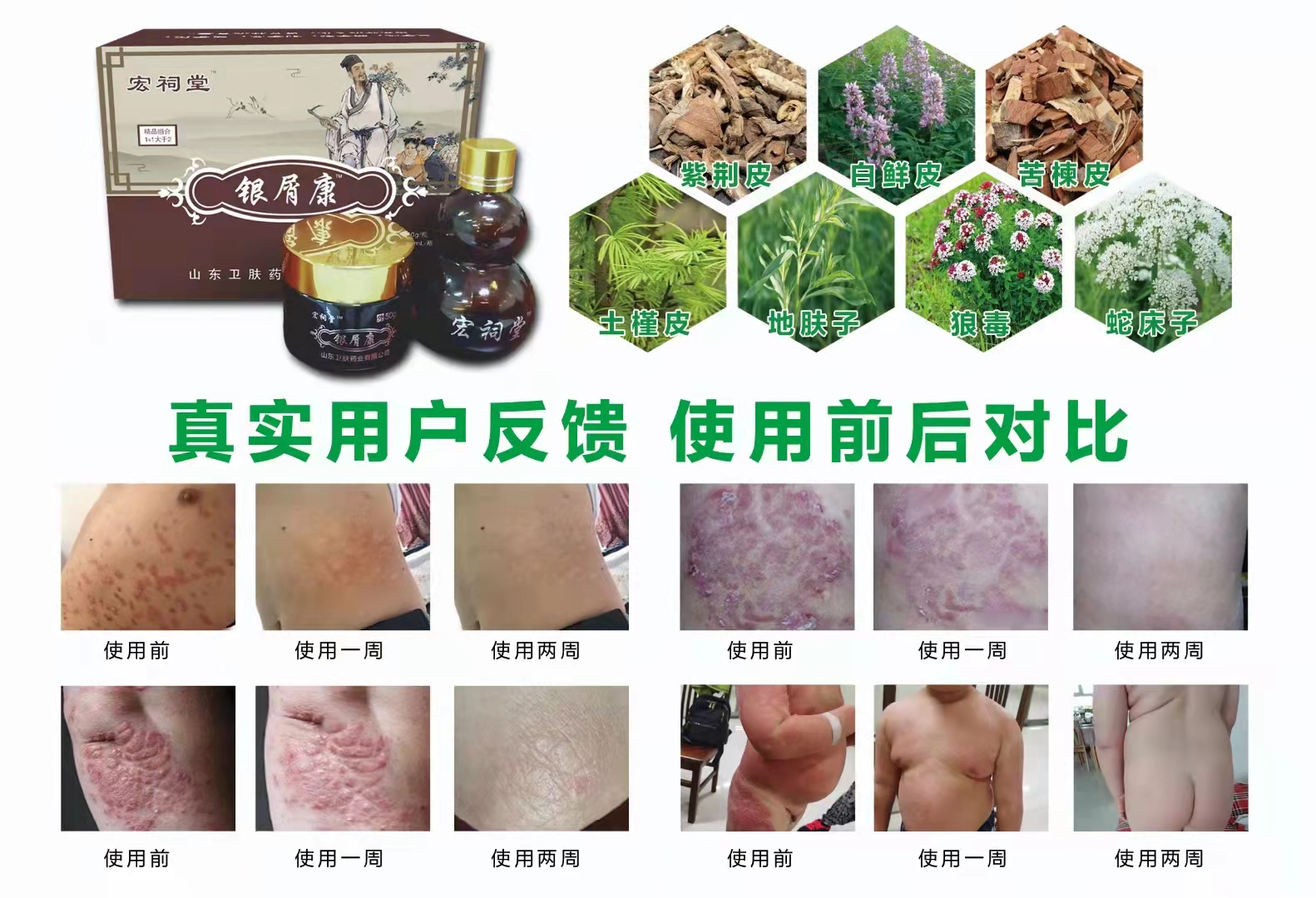 宏祠堂銀屑康2.jpg