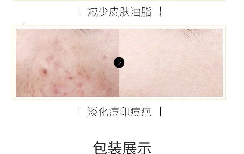 滋養柔順護發素4_07.jpg