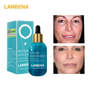 藍(lán)蓓娜修護(hù)精華油貼牌OEM/ODM