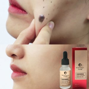 玫瑰精油淡痣水貼牌OEM/ODM