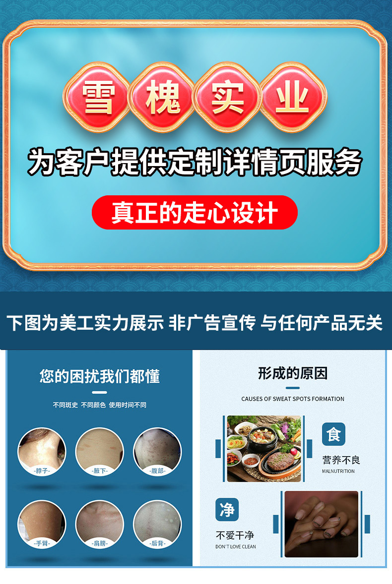 苗丹朱汗斑凈噴劑花斑蘚去汗露皮膚斑身體護(hù)理草本白斑液止汗斑露