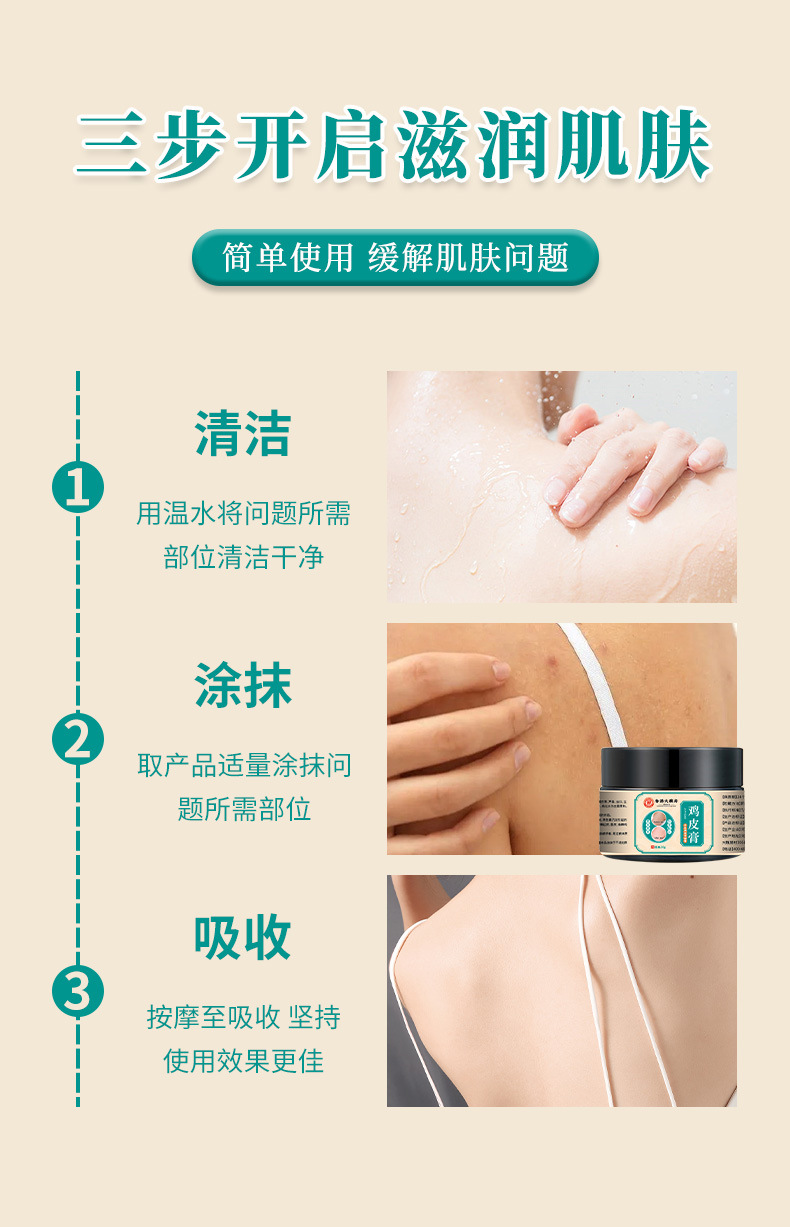 香港大藥房雞皮膏 溫和皮膚粗糙干燥去角質雞皮毛囊魚鱗皮 滋潤膏
